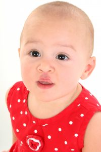 Common facial birth defects