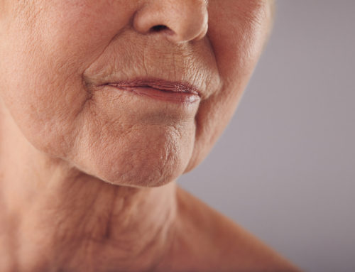 Countering Sagging Neck Skin as You Age