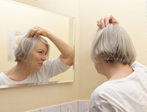 Hair Loss Affects Women, Too