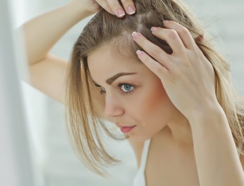 Are You Experiencing Hair Loss? What to Do and How to Make a Drastic Change