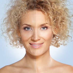 woman with fewer wrinkles