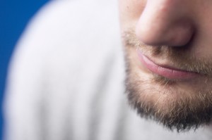 Facial hair transplant to cover scar