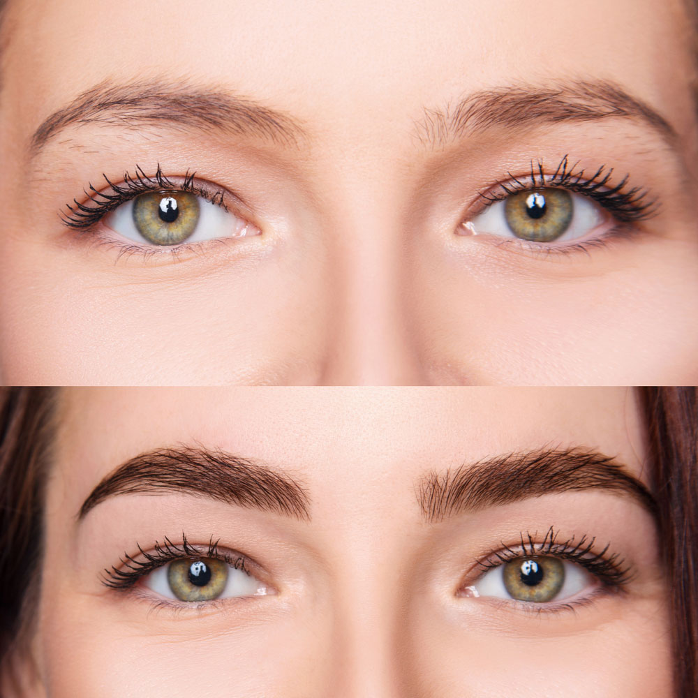 Side by side image of thin eyebrows and thick restored eyebrows