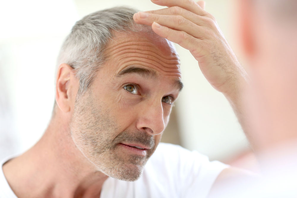 Man looking at thinning hair in the mirror