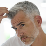 man after scalp micropigmentation