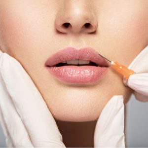 Lip Injectables