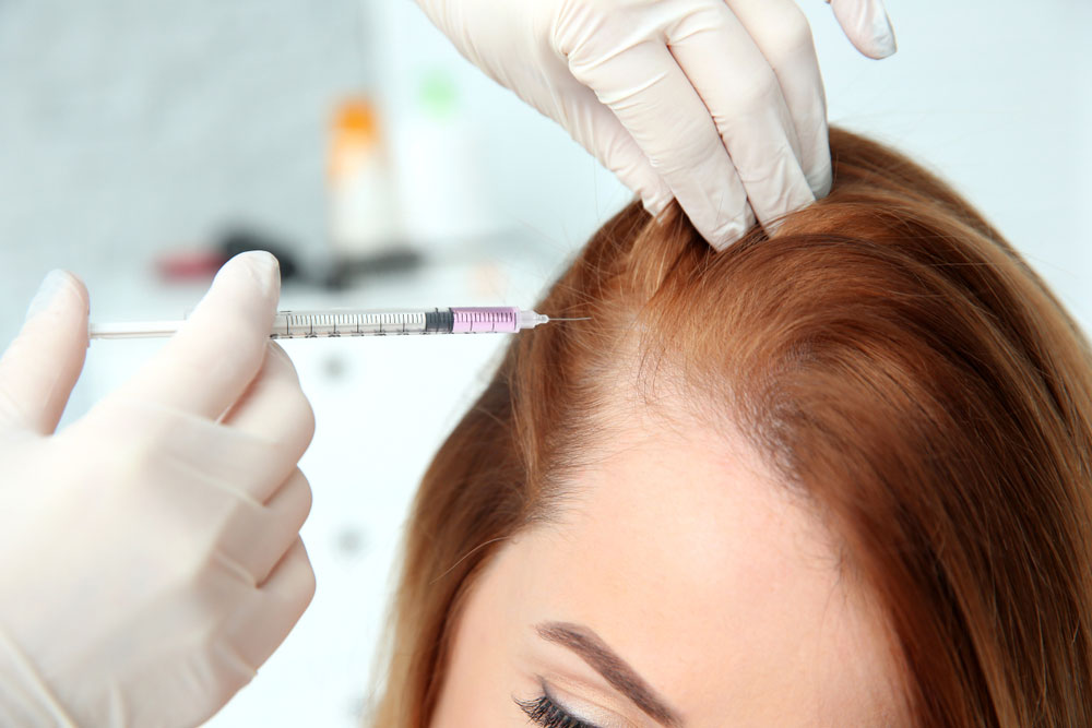 Woman receiving injection to treat hair loss