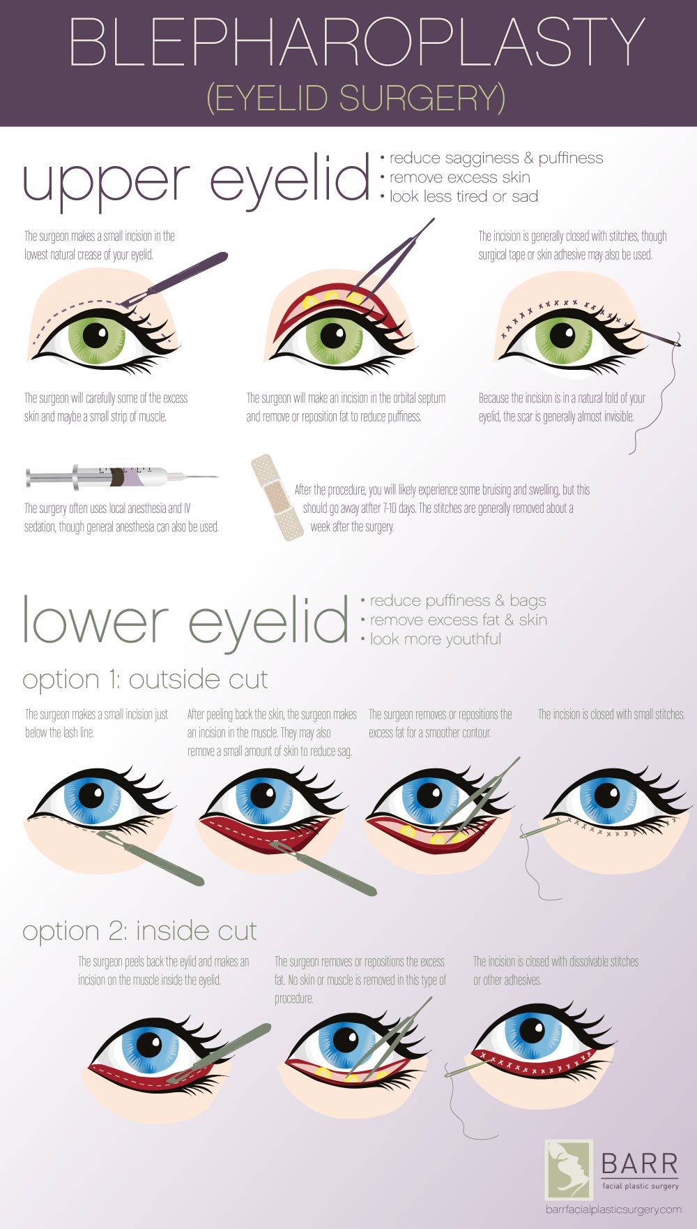 Infographic about Eyelid Surgery