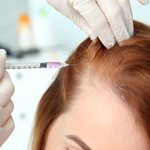 woman receiving plasma hair restoration injection