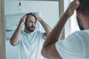 Man in need of hair restoration noticing receding hairline in mirror