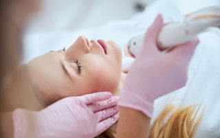 Blonde woman receiving the fractional microneedling treatment
