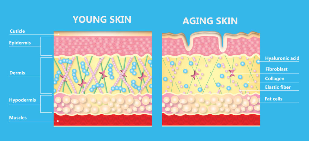 Infographic comparing younger skin with aging skin