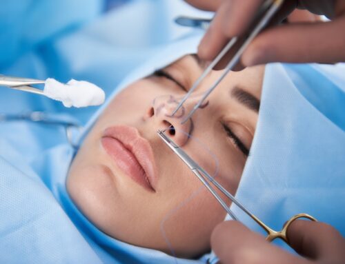 Everything You Need to Know About Rhinoplasty