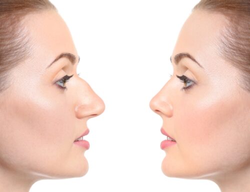 How Much Does Rhinoplasty Cost in Utah?