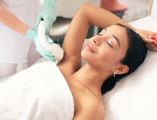 Laser Hair Removal: The Complete Guide