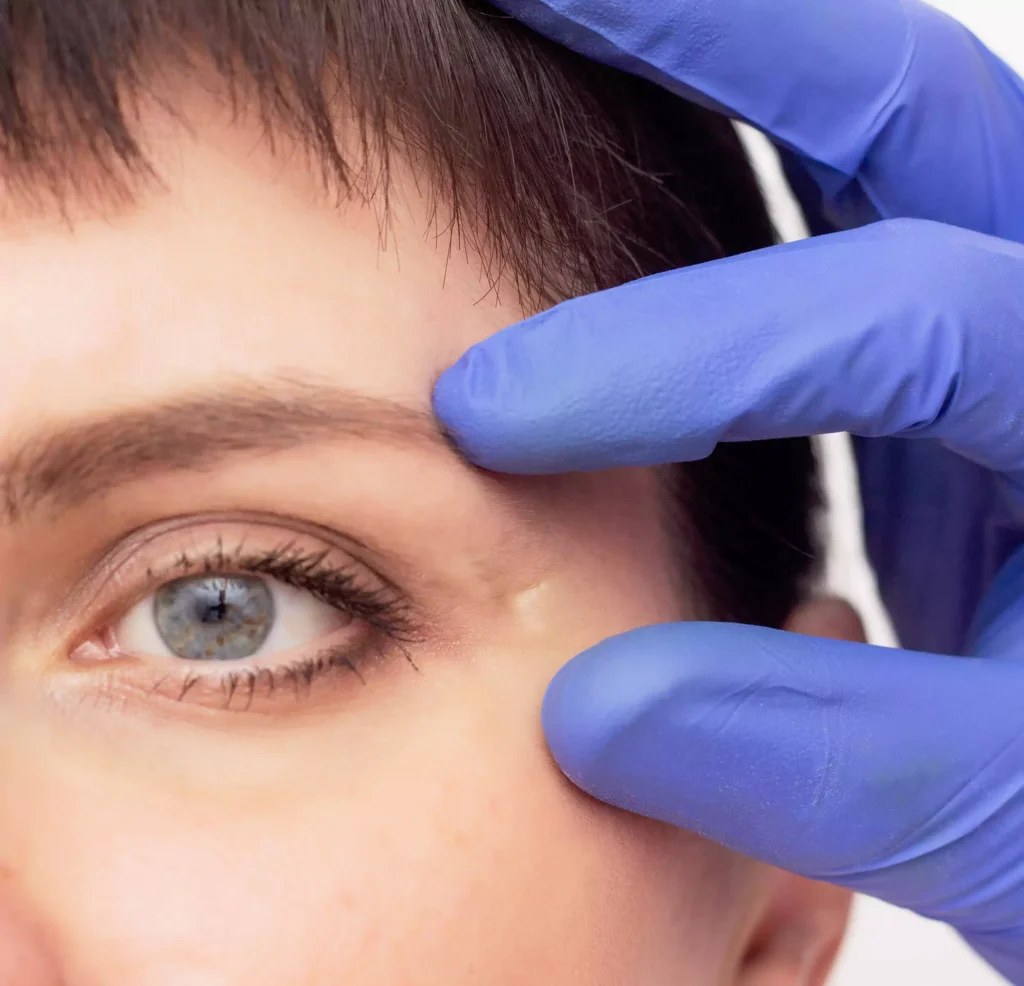 Doctor cosmetologist examines a scar on the girl's face, close-up, skin