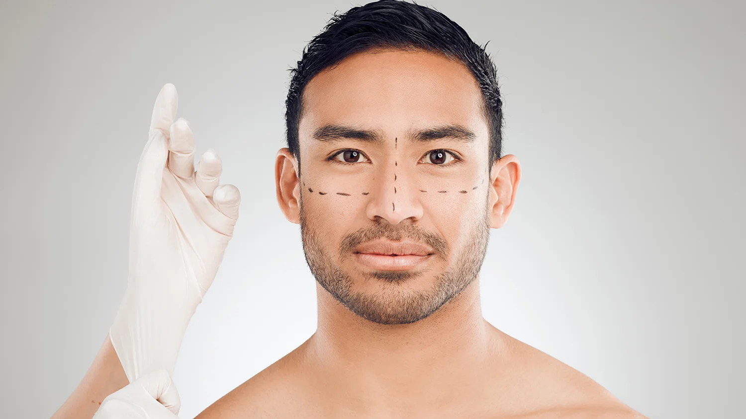rhinoplasty