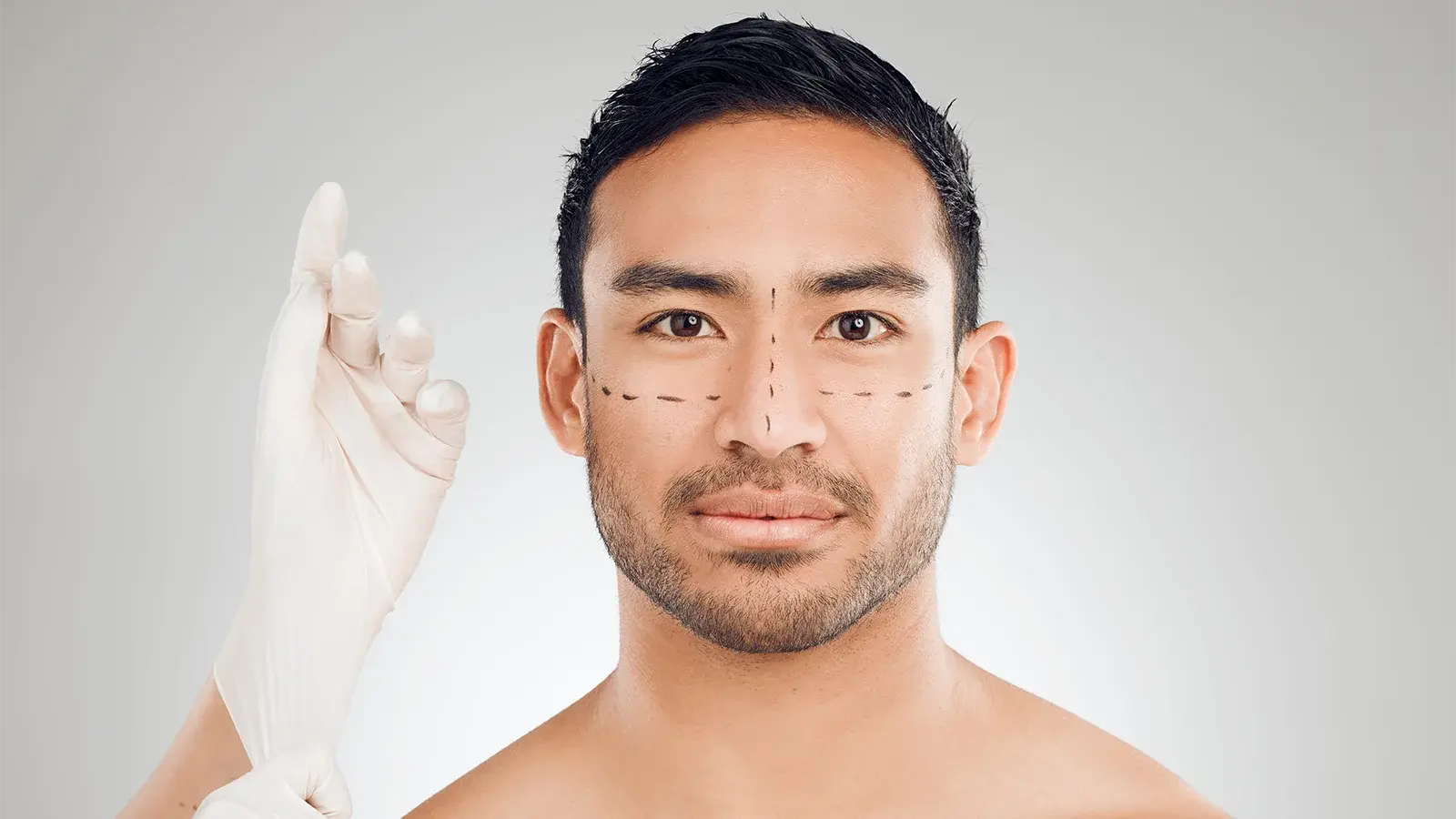 Dark haired man in a consultation for open vs closed rhinoplasty